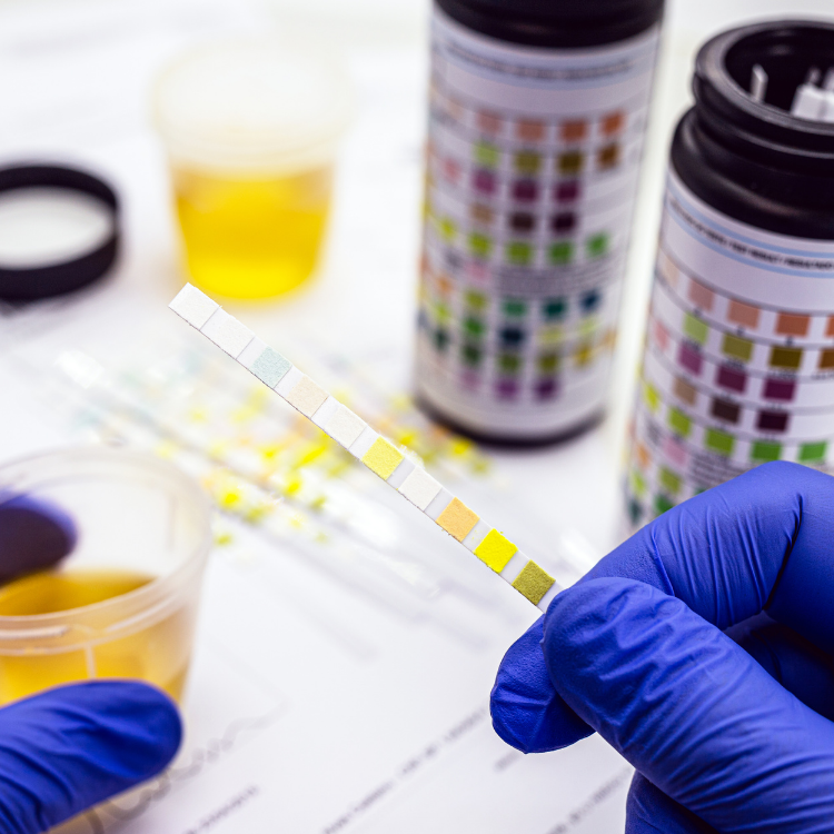 Urine strips ketose meten - ketosestrips