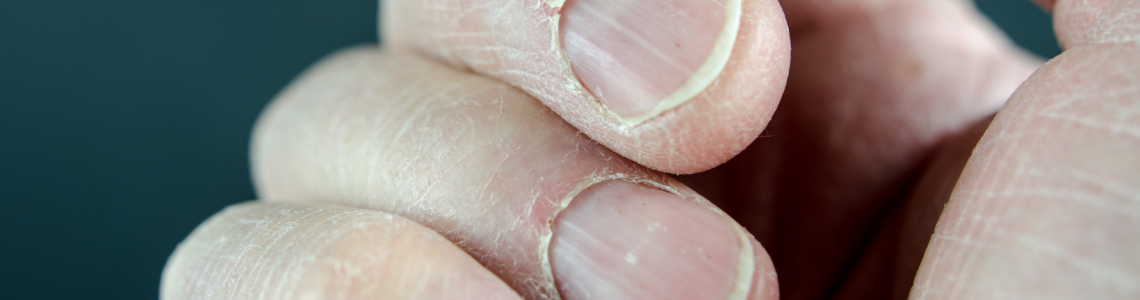 hand met broze nagels